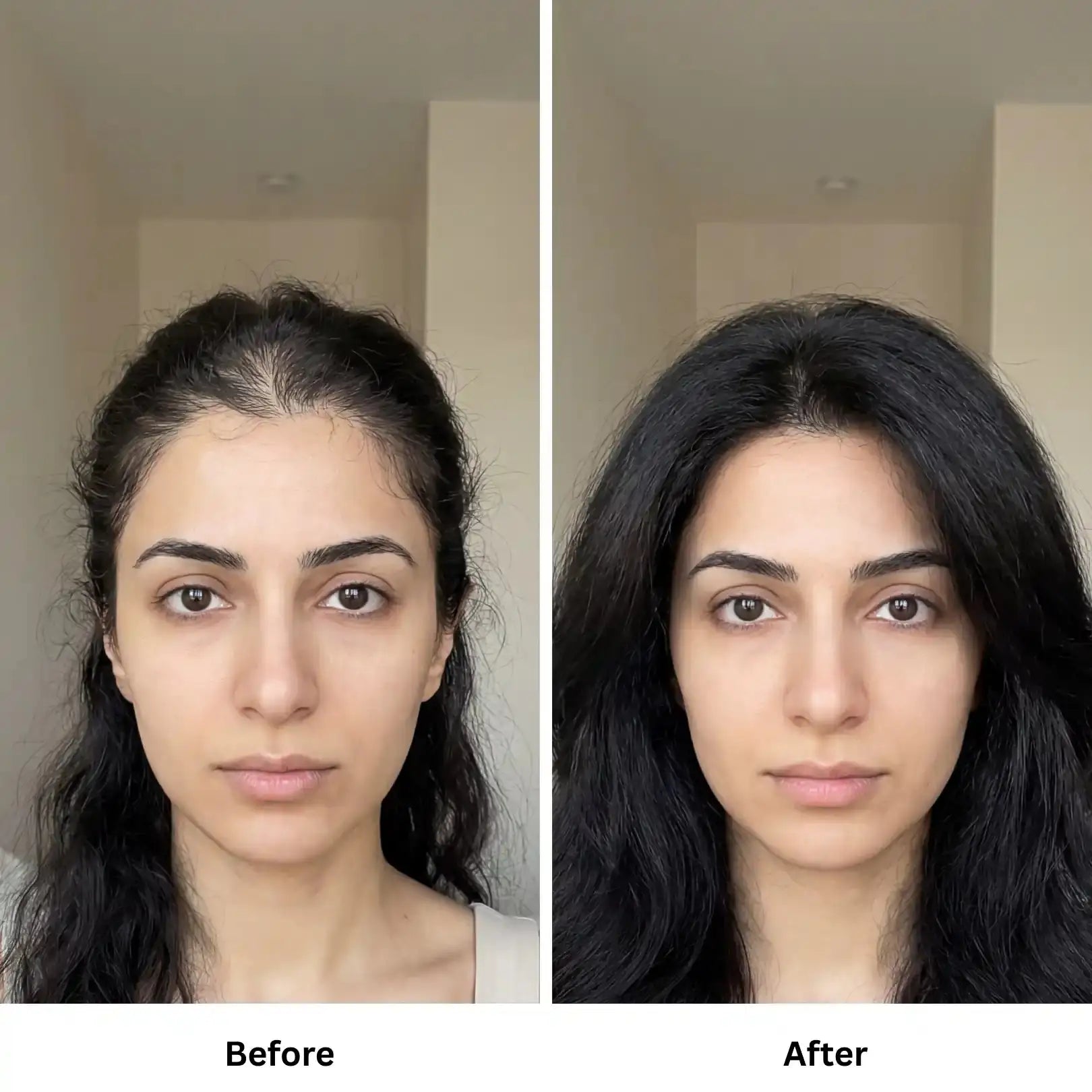  Luminneal5 Hair Tonic Lotion Hair-Tonic vpwvuf-su.myshopify.com